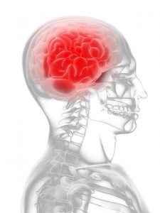 cefaleia - cranio vermelho